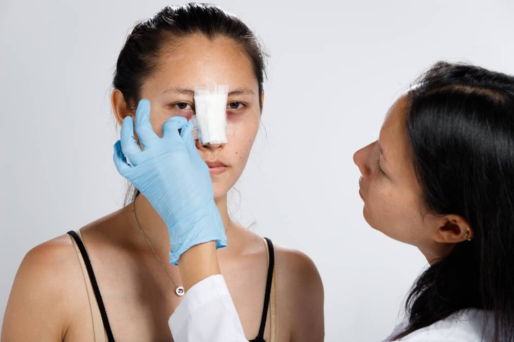 Most people heal from a nose job quickly, but it is important to avoid strenuous activities initially, even if you feel great.