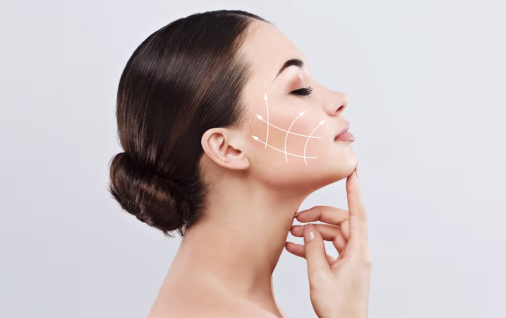 Woman with thread lift guide lines on cheek, comparing non-surgical lift to traditional facelift benefits.