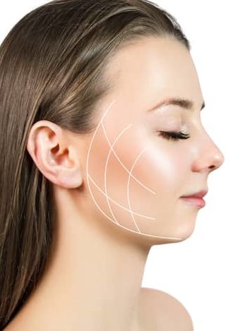 A facelift is performed to tighten sagging skin and muscles in the lower face.