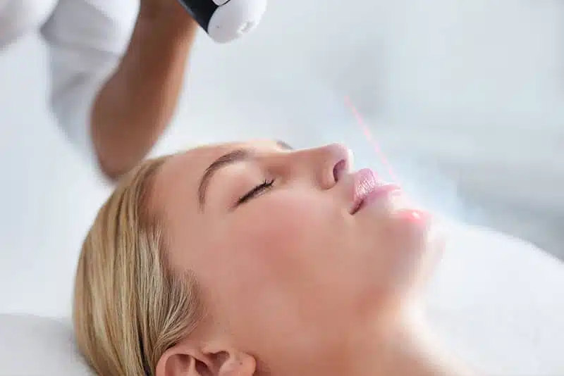 The CO2 laser resurfacing treatment targets the superficial layers of the skin to improve texture and reduce wrinkles.