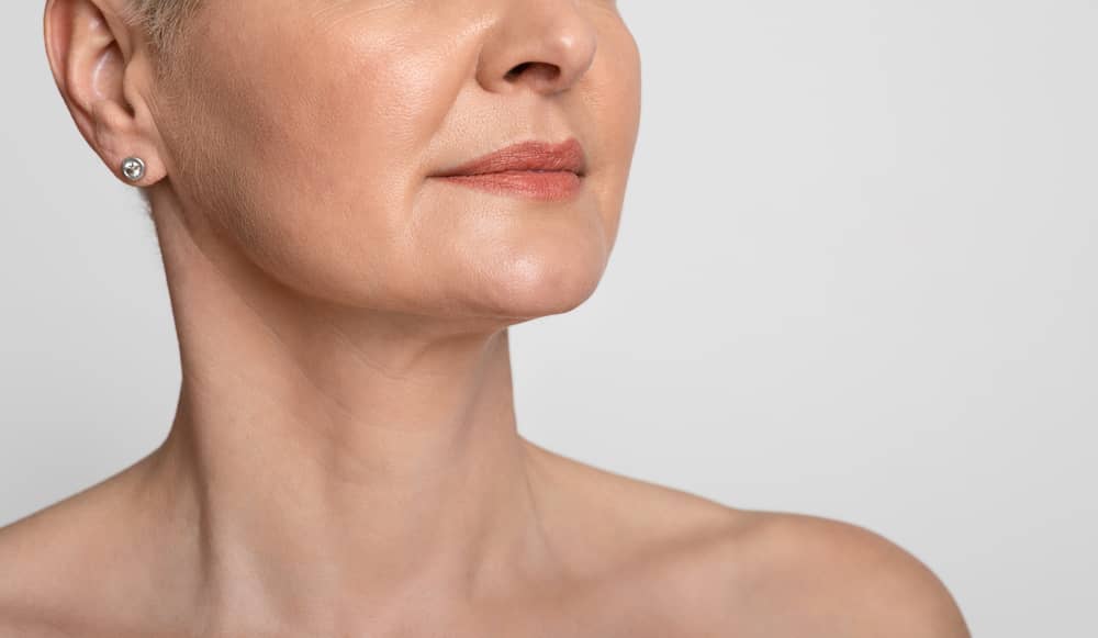 Neck lift is often performed alongside neck liposuction or facelift.