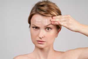 Woman demonstrating brow lift effects, comparing classic and endoscopic methods.