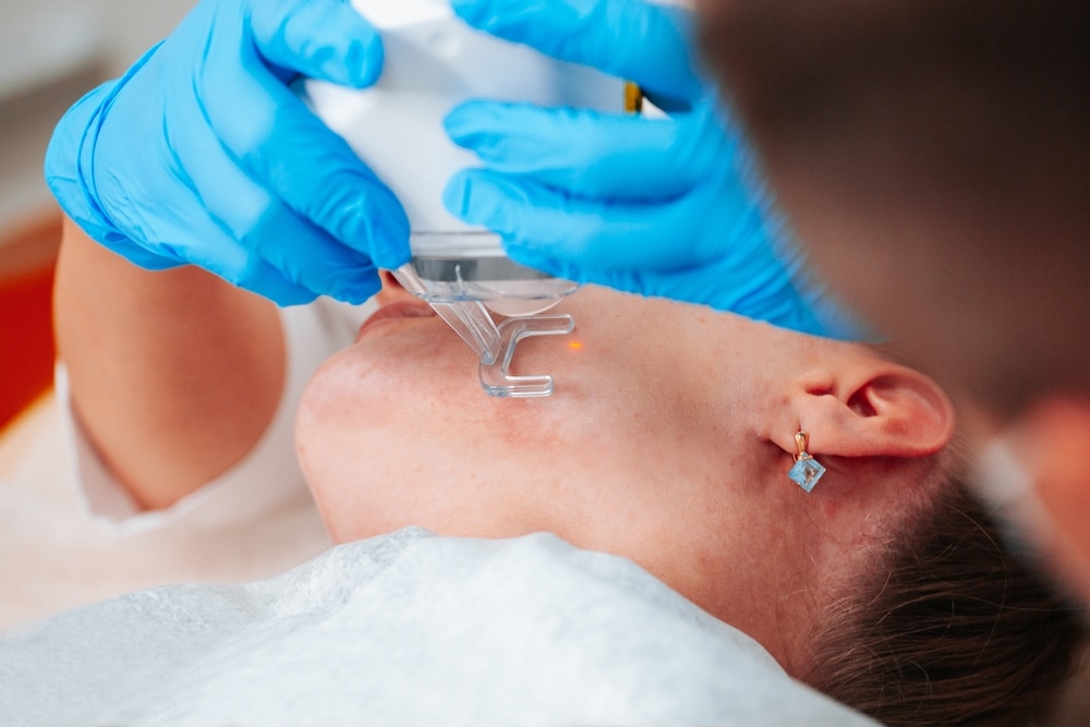 CO2 laser skin resurfacing offers precise treatment, removing damaged skin layers and enhancing texture for customized, satisfactory results.