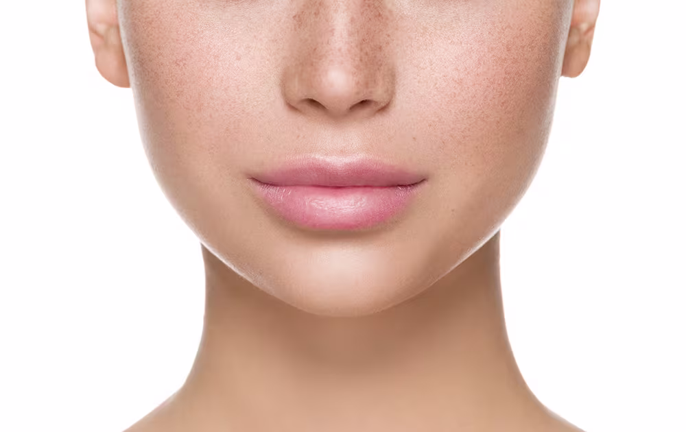 Close-up view highlighting a well-defined chin contour, illustrating non-surgical augmentation results.