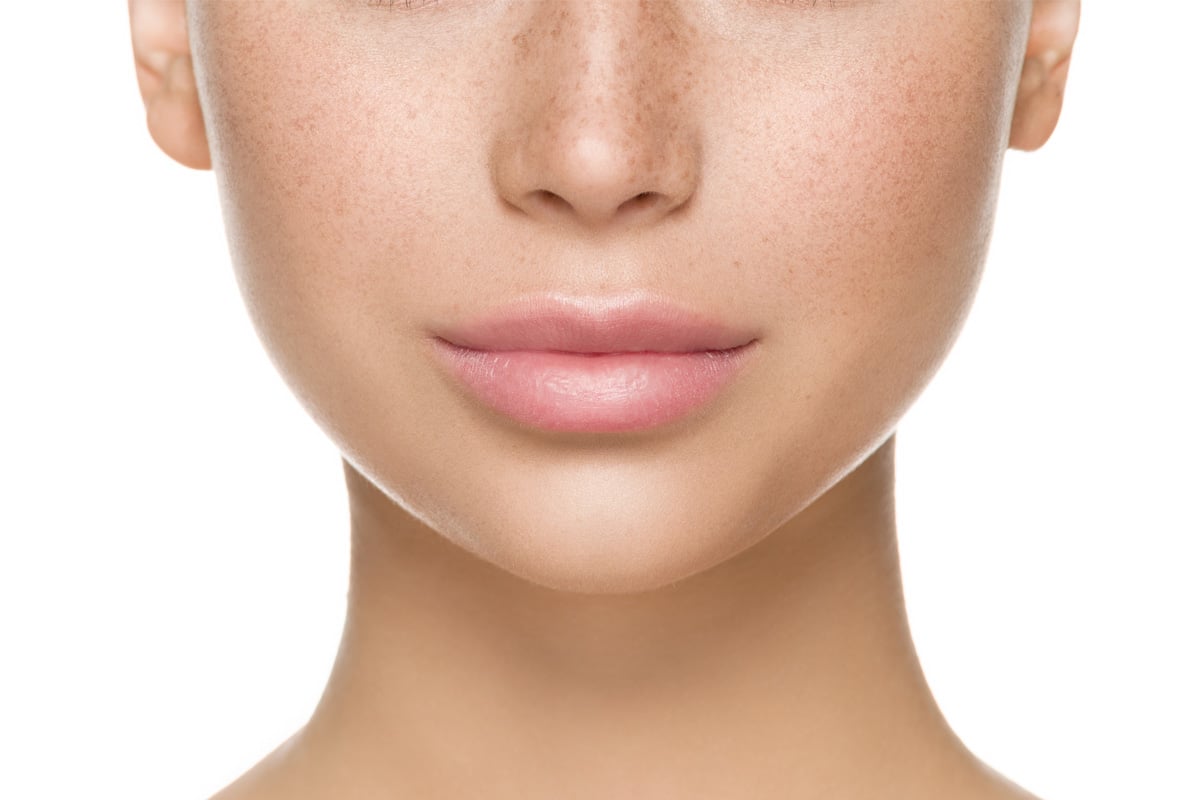 Close-up view highlighting a well-defined chin contour, illustrating non-surgical augmentation results.