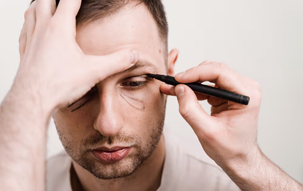 Navigating the delicate days after blepharoplasty requires patience and proper care, but Dr. Homer Hojjat's expert insights provide clear guidance for optimal healing.