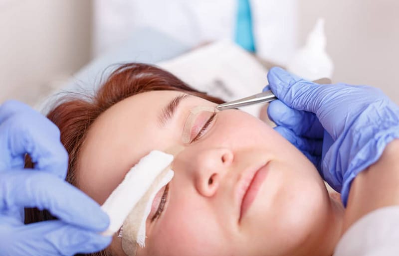 The healing process after blepharoplasty typically involves swelling, bruising, and temporary discomfort, but these symptoms will gradually improve over time.