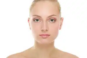 Close-up of a woman's face post-blepharoplasty, showcasing subtle enhancements to eye size and overall facial appearance.