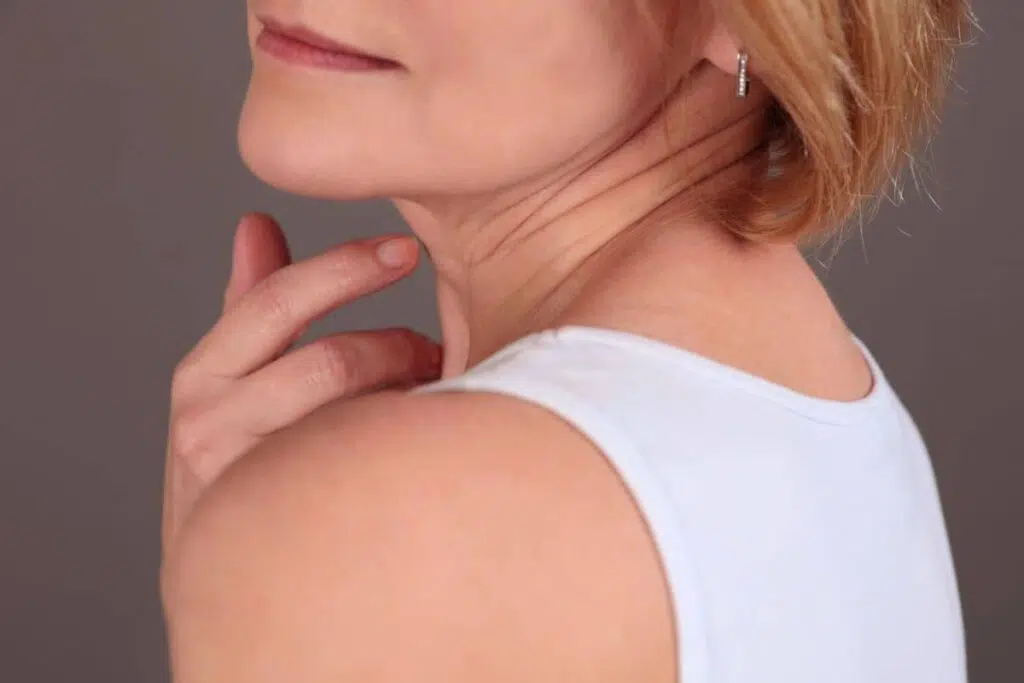 Close-up of mature woman’s neck with visible wrinkles, illustrating need for a neck lift over a mini facelift.
