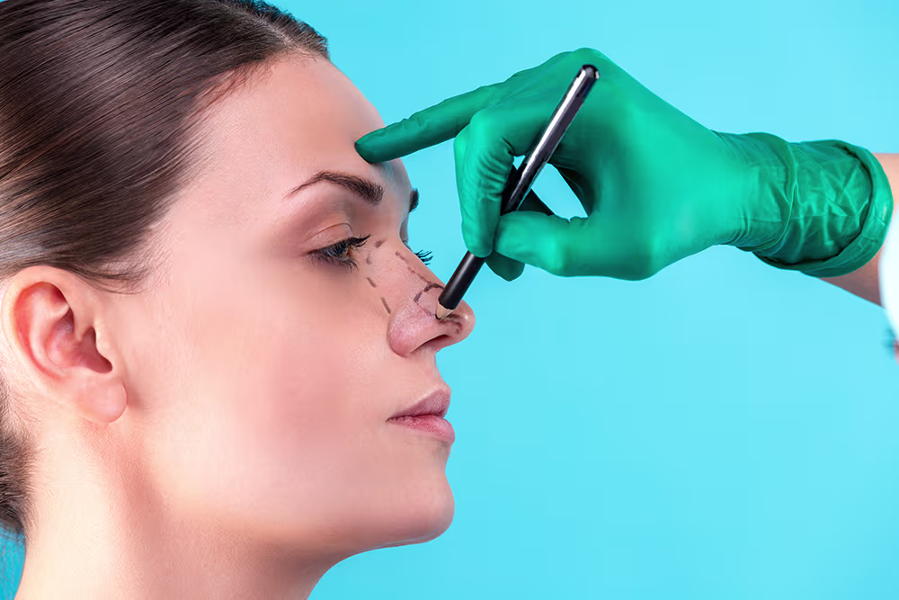 Dr. Hojjat will create a personalized surgical plan to address your specific nasal concerns and achieve your desired results through rhinoplasty in Irvine, CA.